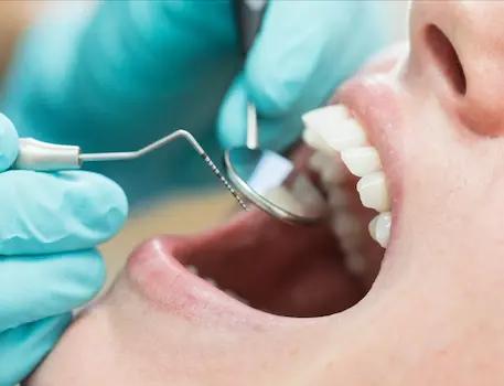 Endodonzia
